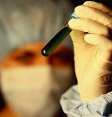 วิธีตรวจหาปรสิต