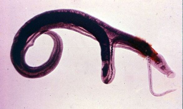 Schistosomes เป็นหนึ่งในปรสิตที่พบบ่อยและอันตรายที่สุด